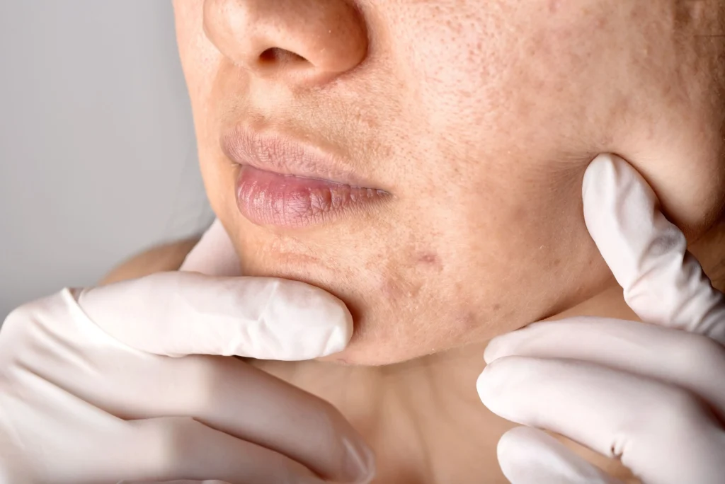 Dermatólogo examinando piel